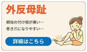 外反母趾